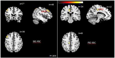 Increased BOLD Signals in dlPFC Is Associated With Stronger Self-Control in Food-Related Decision-Making